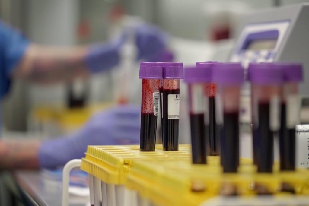 UK to Begin Nationwide Blood Test Trials for Dementia – Neuroscience News