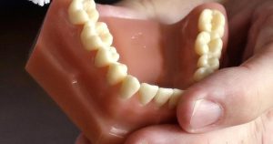 Don’t fall for fake dentists offering veneers and other dental work on social media Don’t fall for fake dentists offering veneers and other dental work on social media