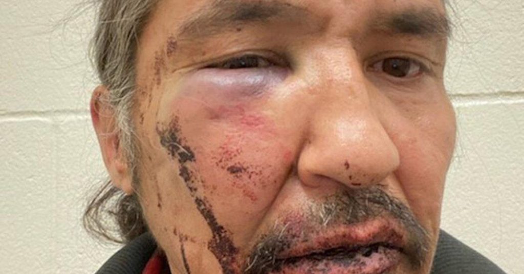 ‘Race did not play a part’: Watchdog clears officers in arrest of Alberta chief