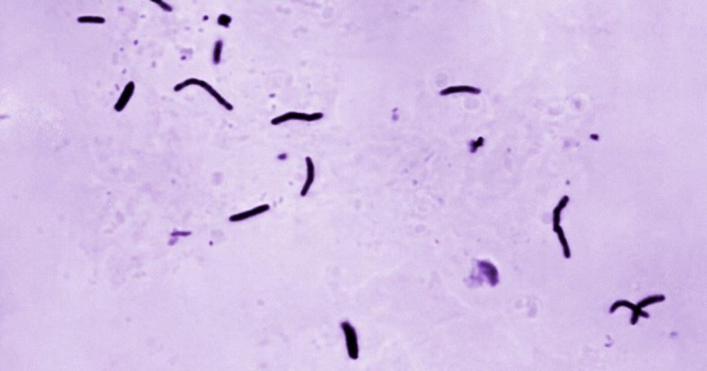 The tuberculosis outbreak in Kansas is alarming. It’s not the biggest in US history though, CDC says