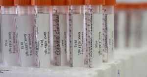 Canada advances toxic label for ‘forever chemicals,’ phased regulation approach