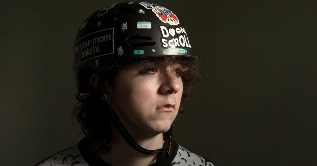 Edmonton man beaten in Dominican Republic to have piece of skull replaced |