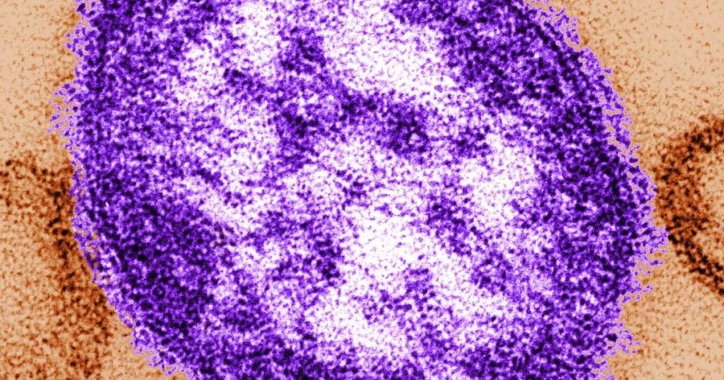 Manitoba warns of new measles exposure sites south of Winnipeg
