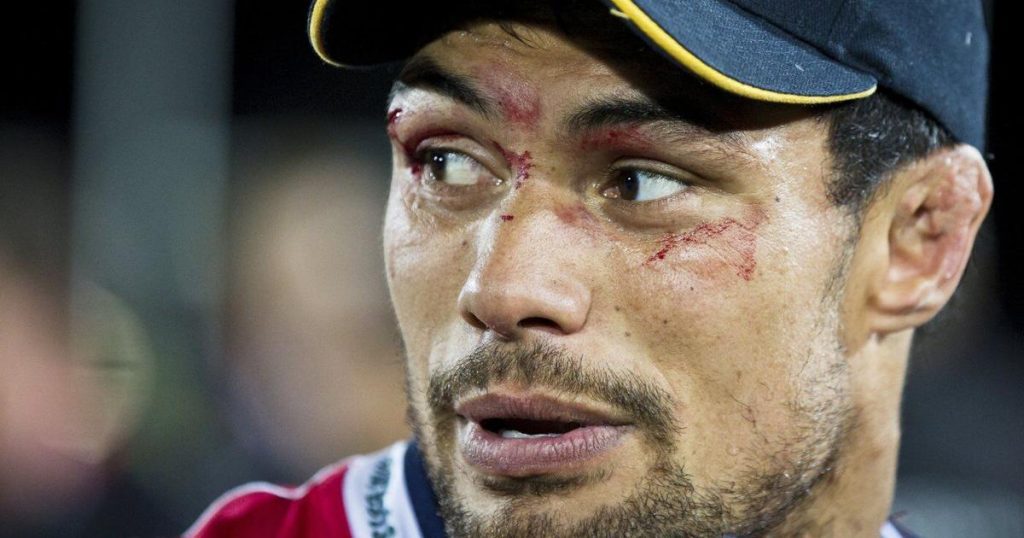 Ex-rugby player Shane Christie, who called for study of concussion, dies at age 39