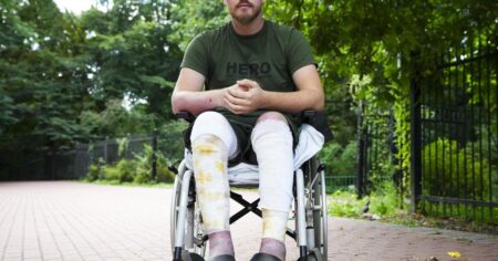 ‘Nothing’s changing’: Calgary man recovering in Ukraine sees no end to war ‘Nothing’s changing’: Calgary man recovering in Ukraine sees no end to war