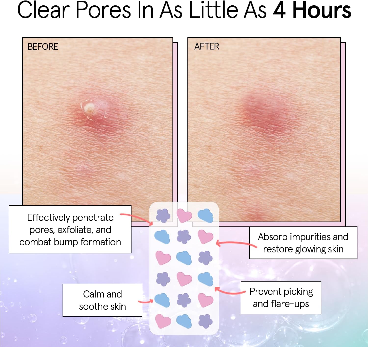 grace & stella Award Winning Hydrocolloid Patches ... - Image 4